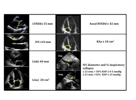 lv end systolic diameter.